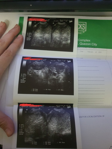 Positive ba? What to do?