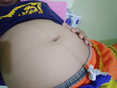20week5Day
