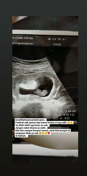 Janin 9 minggu meninggal dlm kandungan karena tidak berkembang