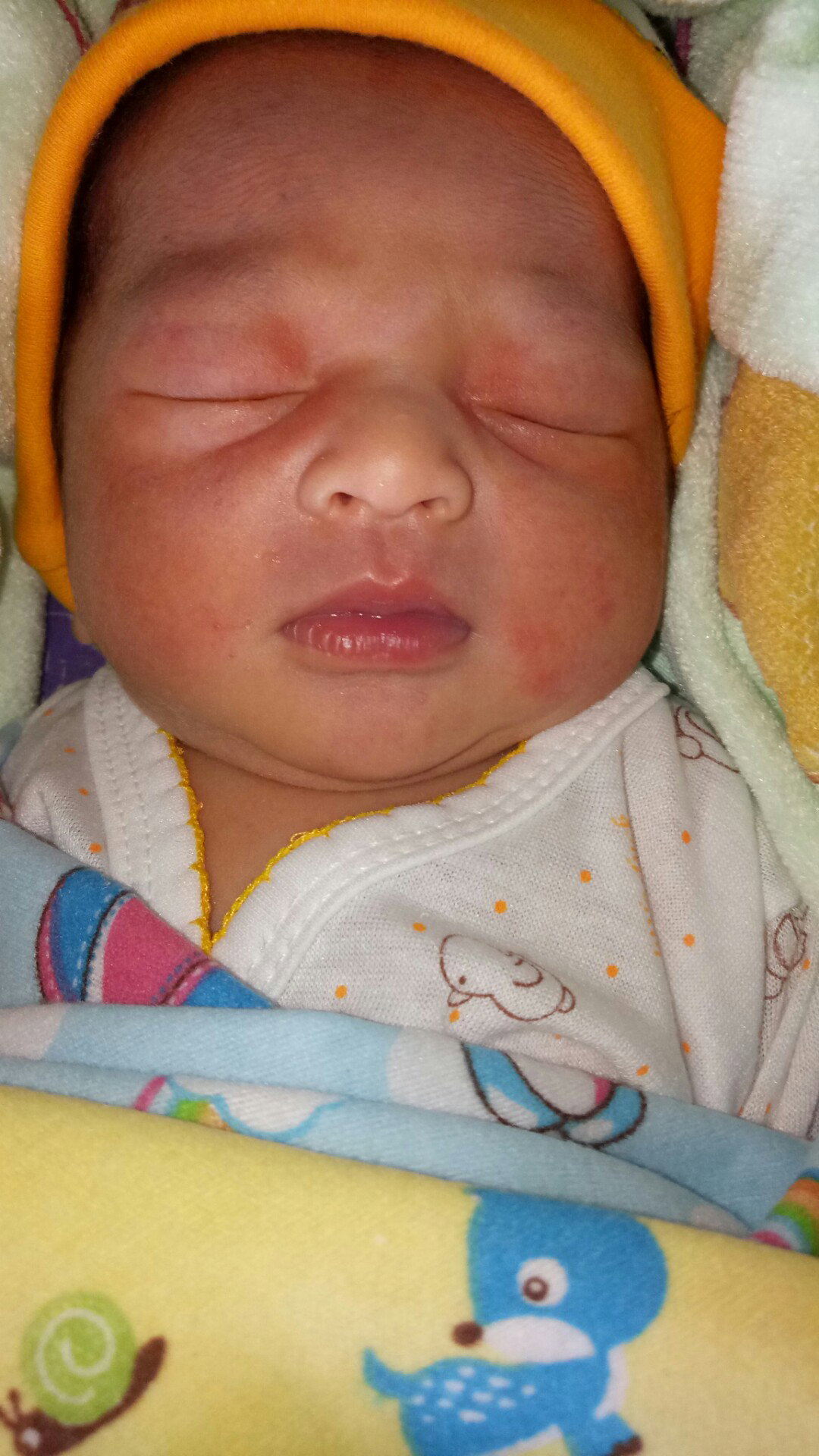 ruam di wajah