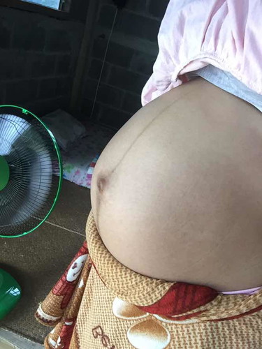 ท้องแรกตอนนี้ได้ 32week แร้วจ้า
