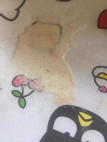 ถามหน่อยจ้า น้องแหวะนมแล้วก้ออาเจียนแล้วอาเขายนบ่อยมีสีแดงป่นยุไม่รุว่าใช่เลือดไหมอยากทราบว่าอาการแบบนี้แล้วอาเจียนสีนี้เปนอันตรายกับน้องไหมค่ะ