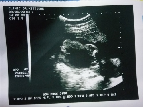 หญิงหรือชาย