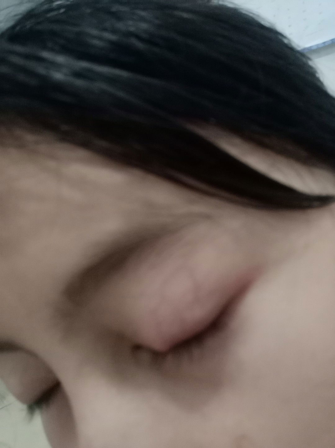 mata bintit sejak hamil