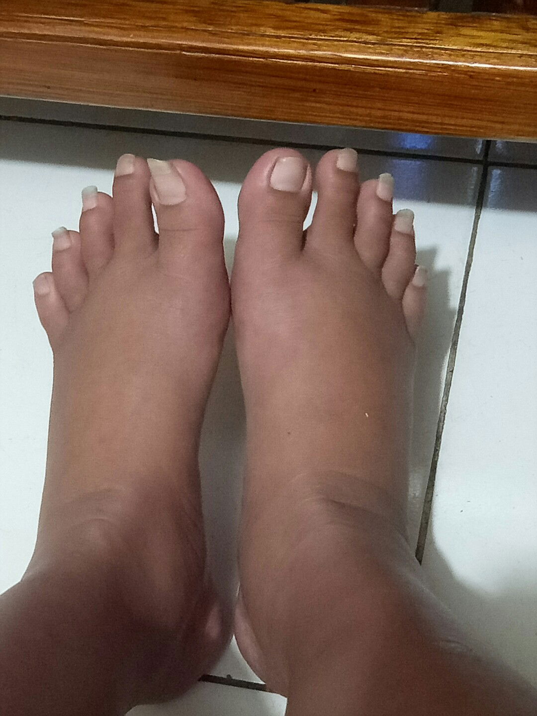 halo bun ada gx sih kalian mengalami kaki bengkak seperti saya klo ada yg sama kasih pendapatnya dong bun  kata dokter sih klo duduk kaki gx usah begantung dan tidur jga dibawah kaki alas bantal bun apa pengaruh yah bun???