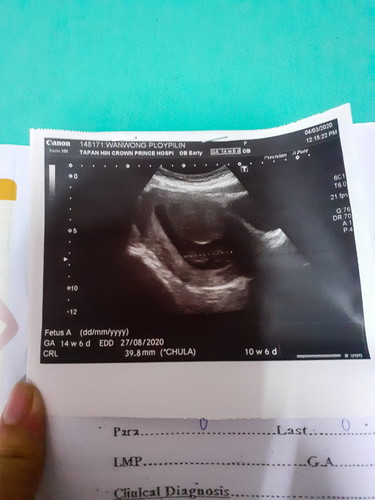 10 week 6 day