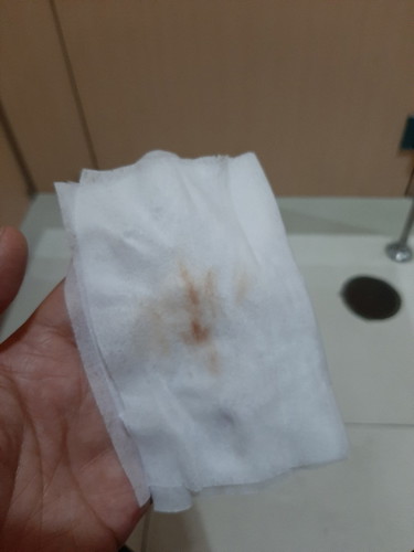 implantation or menstruation ?