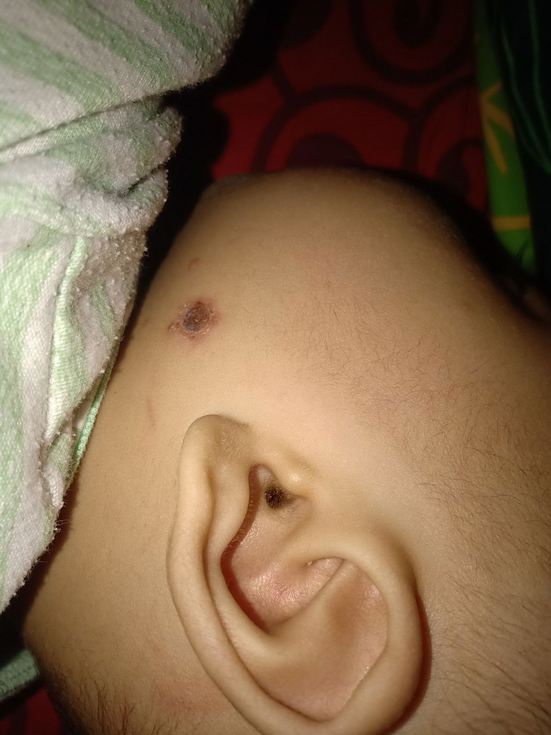 obat untuk luka ini apa ya?