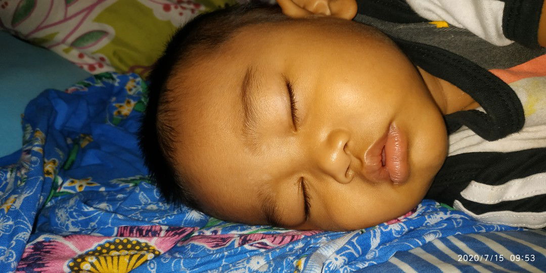 bercak putih di dahi