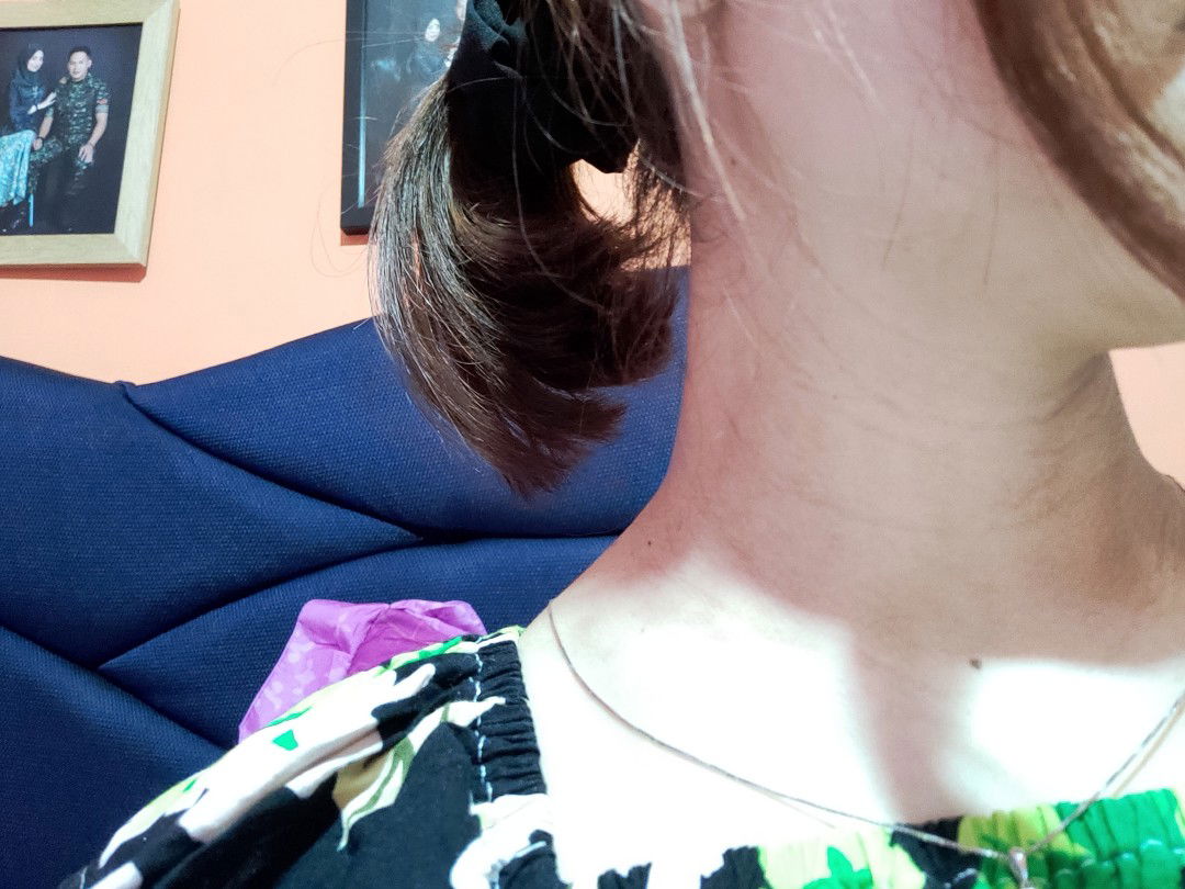 garis hitam dileher saat hamil