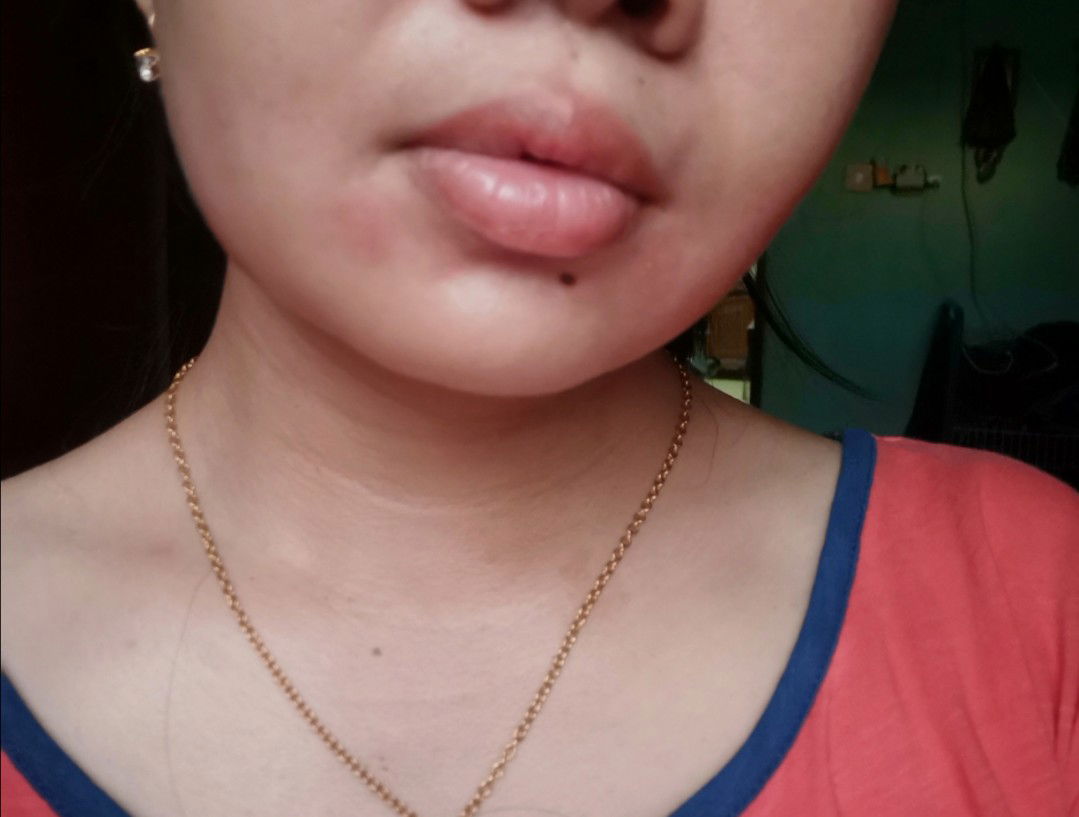 Kulit Wajah Kering Dan Sensitif