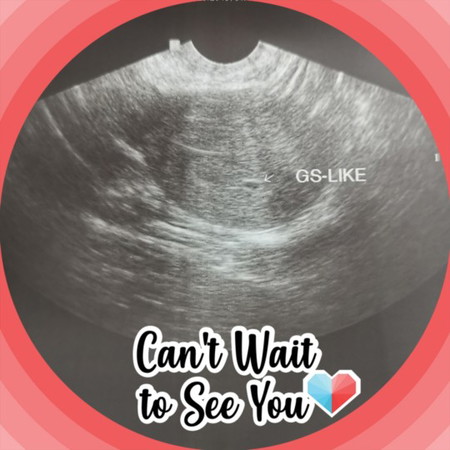 Is this a sure sign of pregnancy?