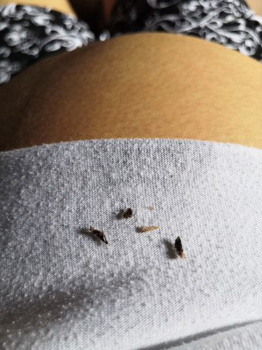 OPERATION LINIS PUSOD - 36 Weeks