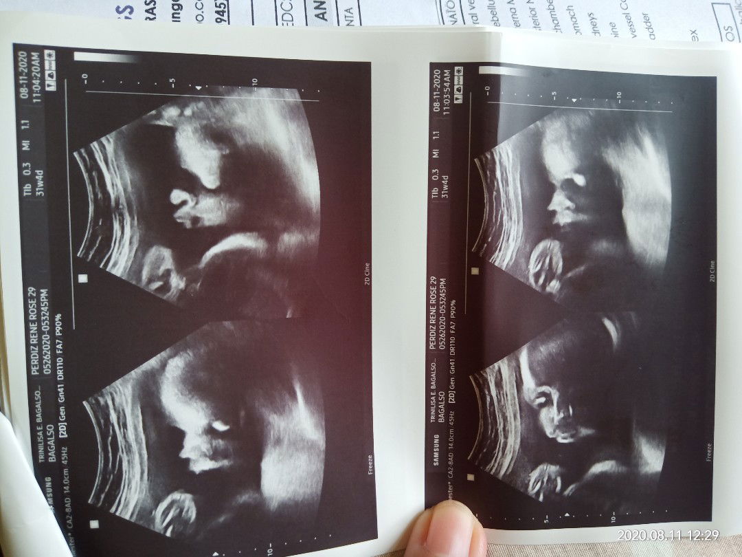 nheo Rafael profile icon