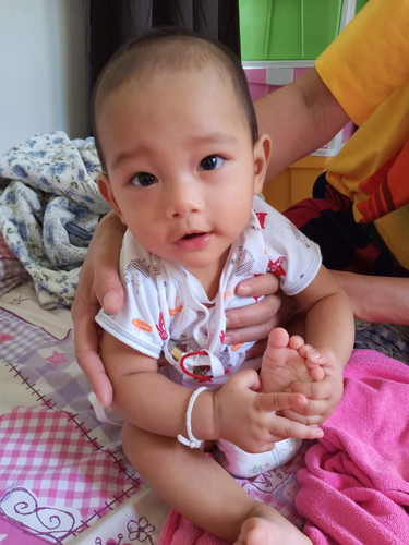 ลูกไม่นั่งไม่เดินทำไงดี