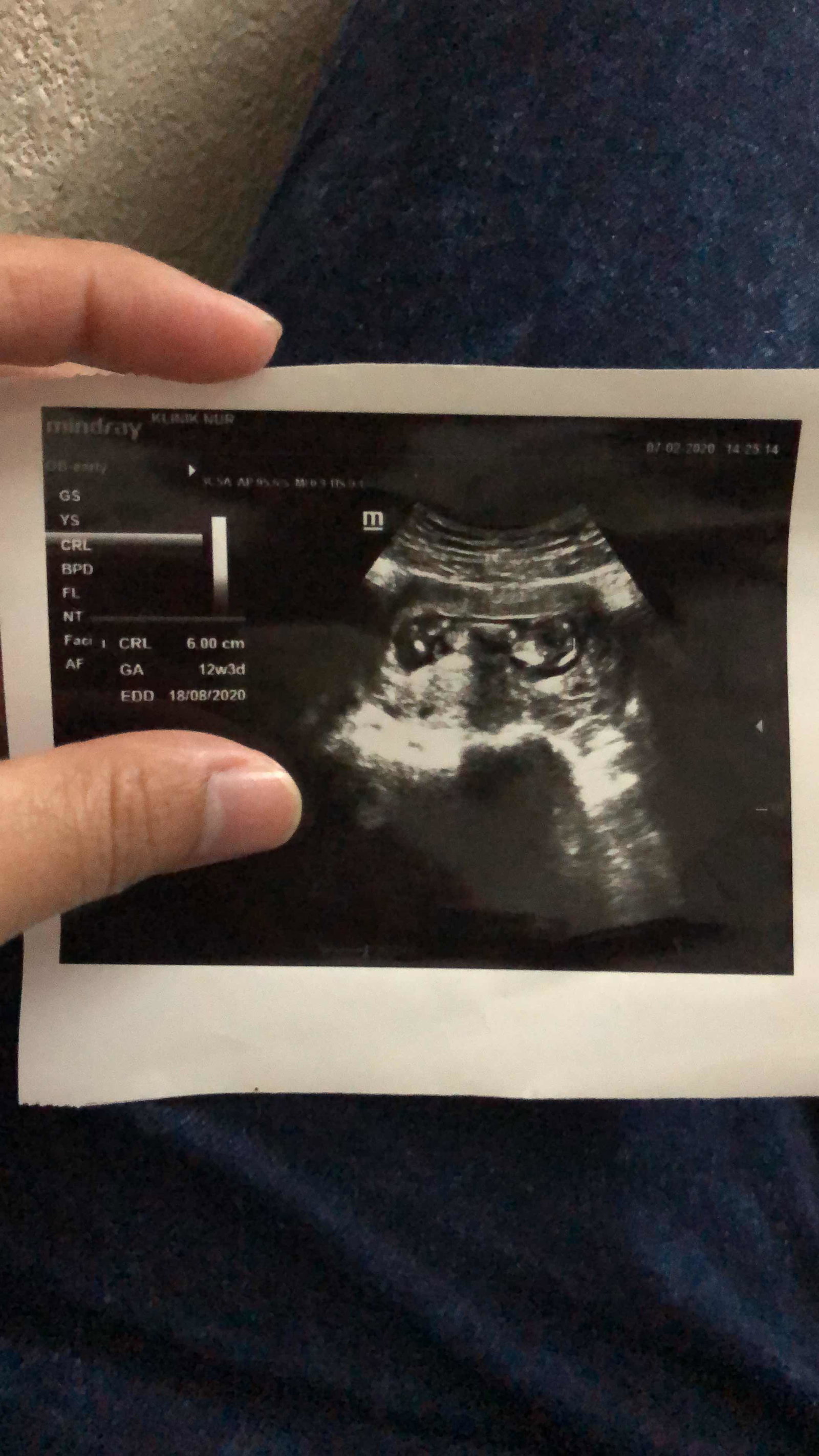 Aida Suraya profile icon