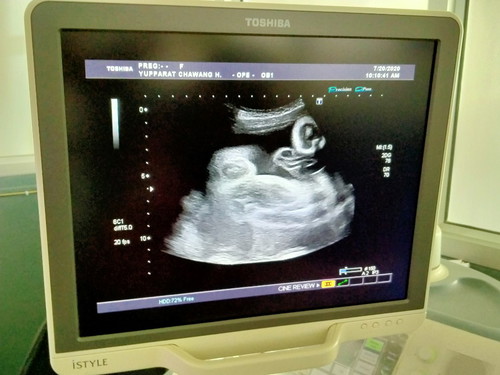 เจ้าตัวเล็ก❤️