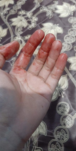 สุดท้ายน้องก็ไม่อยู่กับเราเพราะมดลูกไม่ดี?