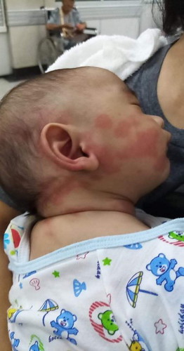 น้องเเพ้นมผงคะ