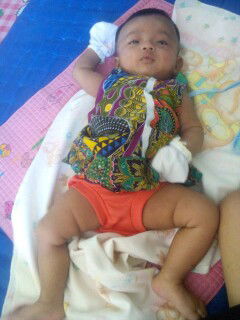 alergi asi dan biang keringat