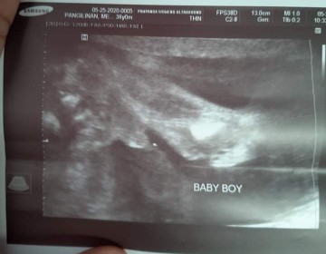 it's a boy!