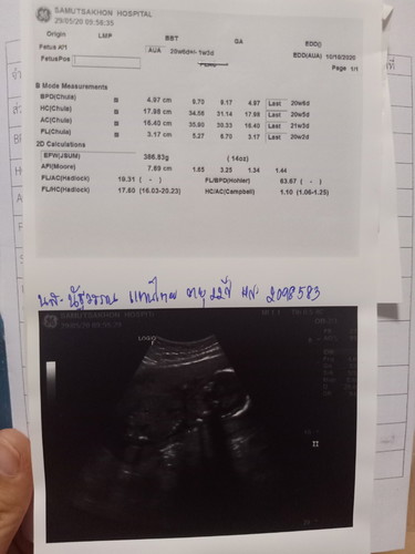 เป็นตกขาวไหลตลอด..ท้องได้27+2วีคแล้วค่ะ