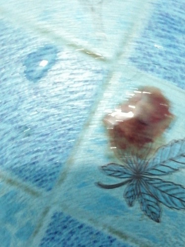 มีสิทท้องไหมค่ะ