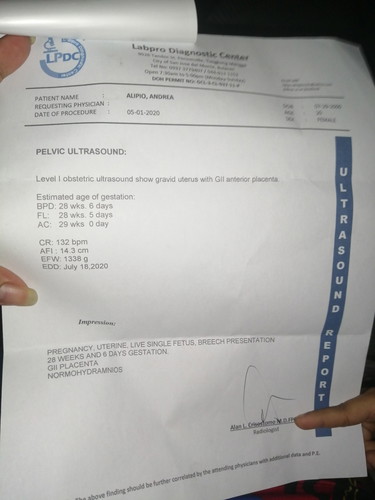 Ultrasound Result