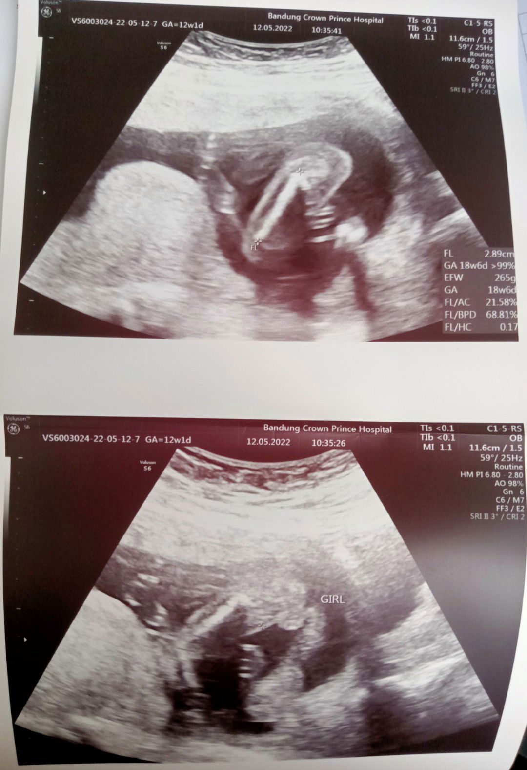 Chamalporn Worajit profile icon