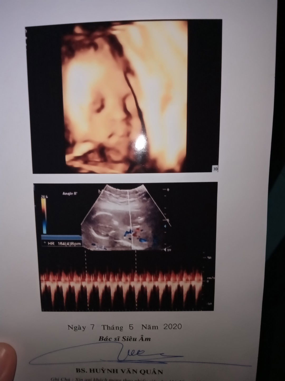 18w5d 290gam nhỏ không ạ