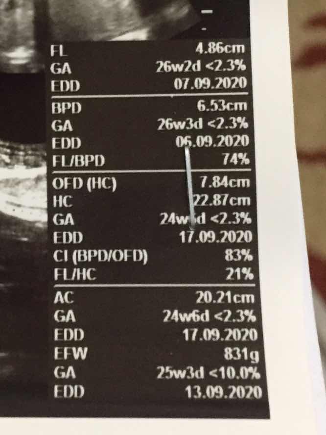 CRl di USG tidak ada