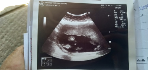 อยากรู้ว่าผู้หญิงหรือชาย