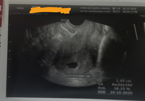 Sonography