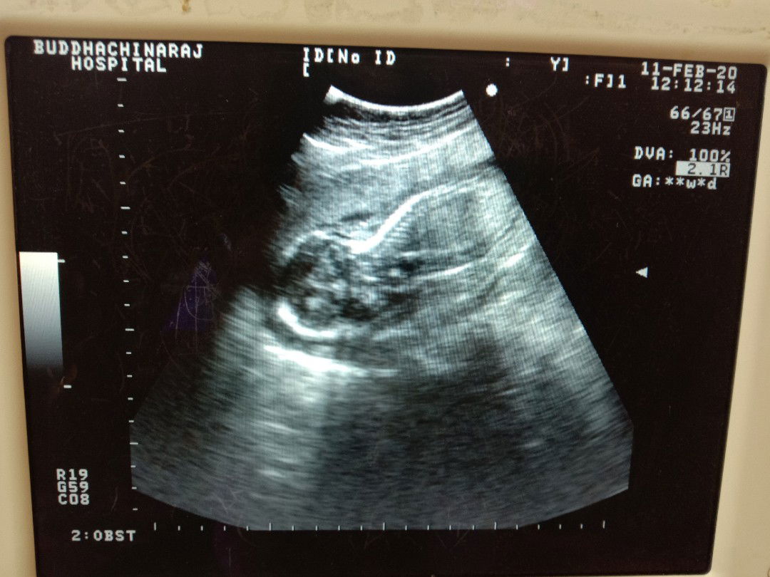 ตั้งครรภ์19สัปดาห์