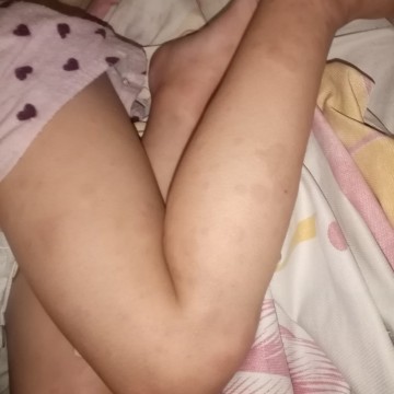 Anu Po Ba Itong Sakit N Toh.... Anu Po Pede Kong Gaqin