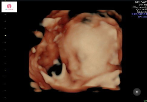 Dini Alfira profile icon