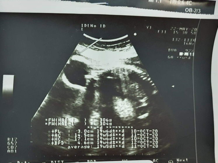 ใบซาวด์