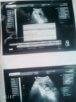 first ultrasound