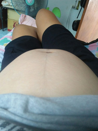ขอดูท้อง