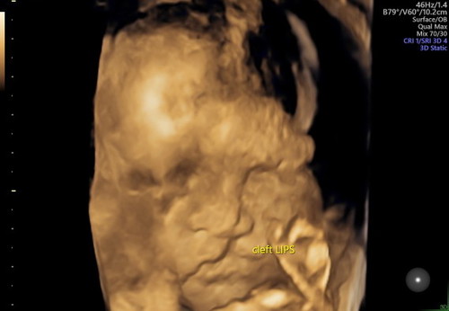 minta do'a dari para bunda