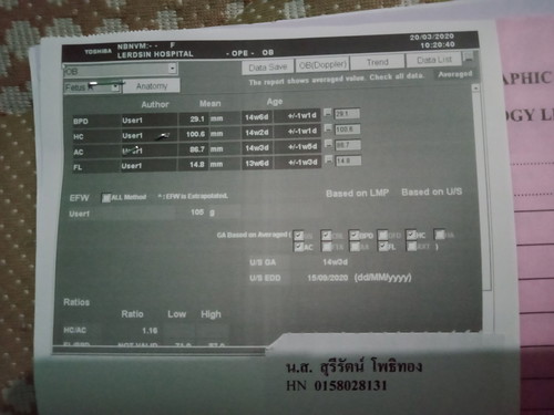 อยากทราบน้ำหนักลูก