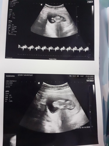 พึ่งไปฝากครรภ์มาจ้า แม่ๆๆบ้านไหนฝากครรภ์ตอน3เดือนบ้างค่ะ ขอเสียงหน่อย??