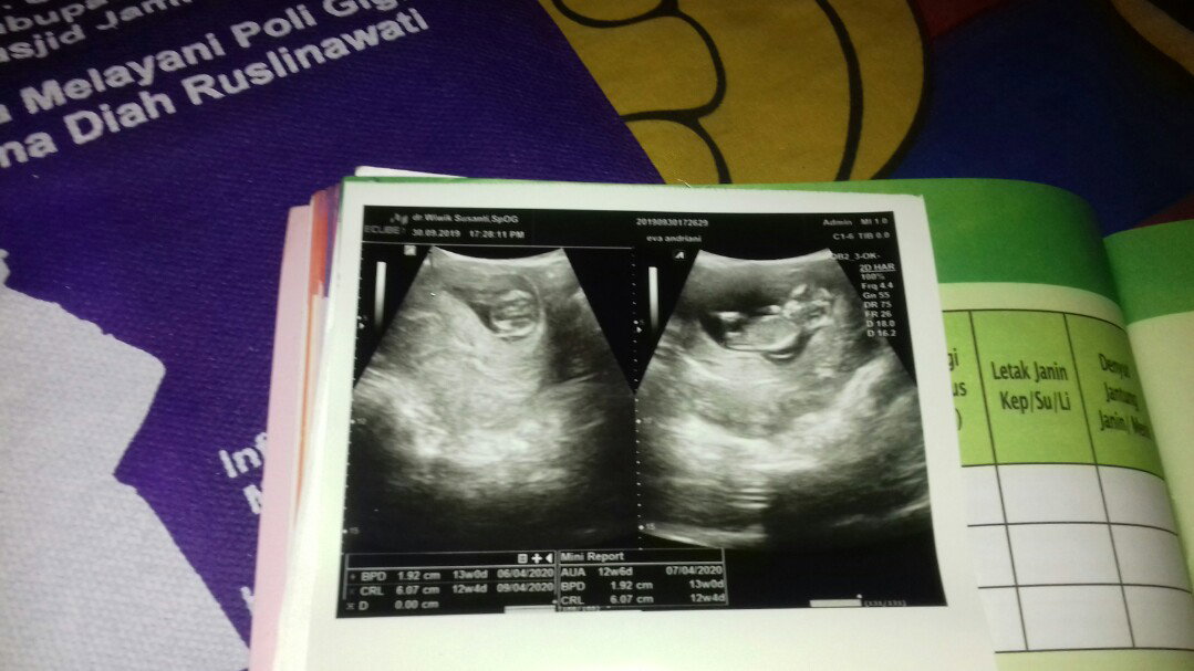 12 Week