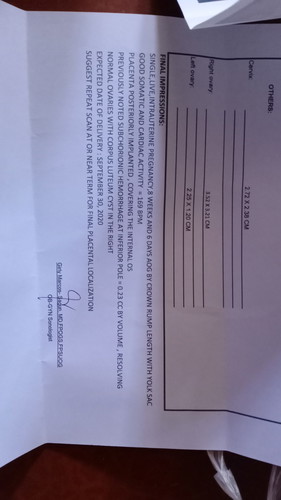 mababa ang inunan