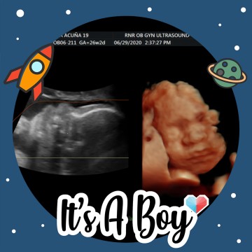 its a baby boy!