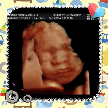 its a baby boy