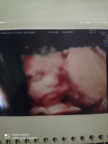 mohon doa smoga dipermudahkan ☺️