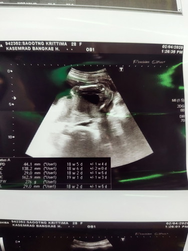 อยากทราบว่า ดูเพศลูกยังไงค่ะ??