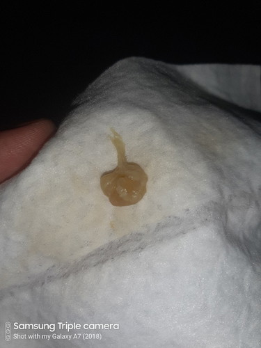 Mucus plug po ba ito?