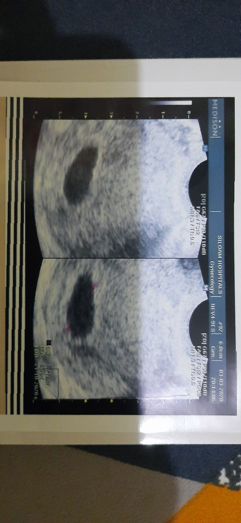 masih belum ada janin nya